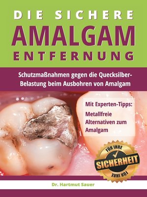 cover image of Die sichere Amalgam-Entfernung